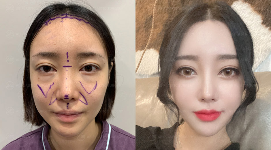 AB Plastic Surgery